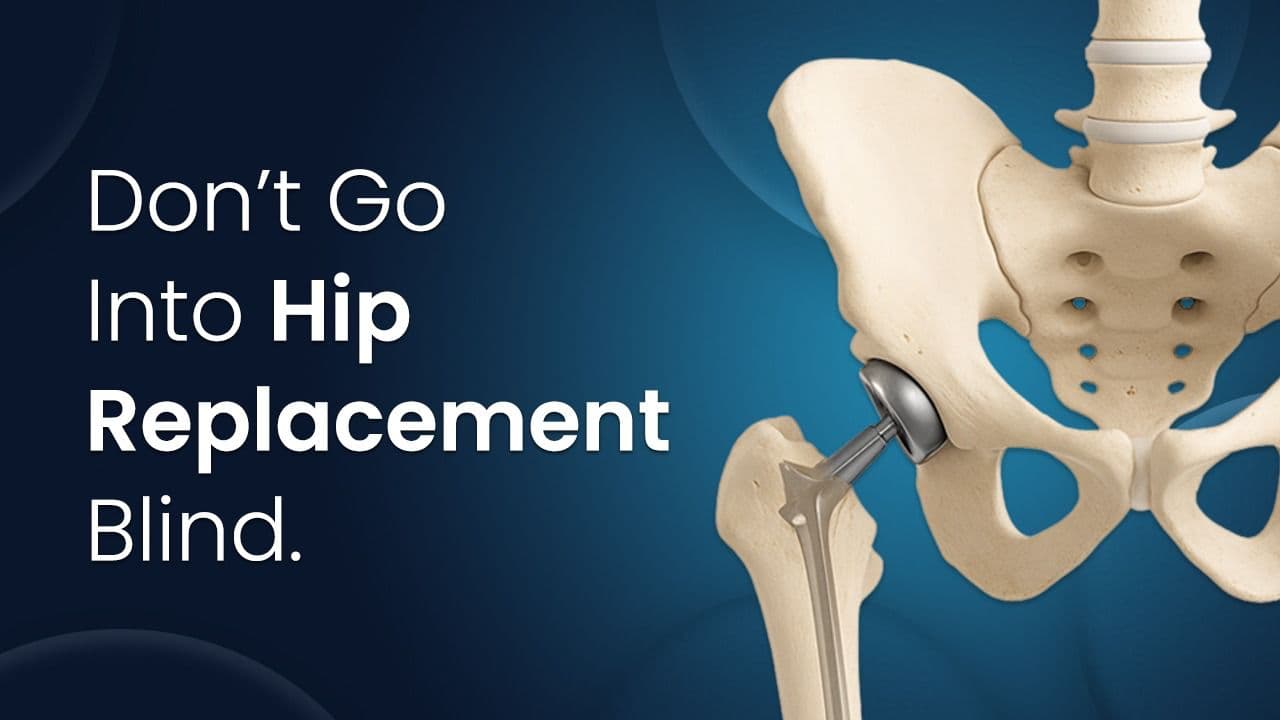 Hip replacement alignment walkthrough – video thumbnail