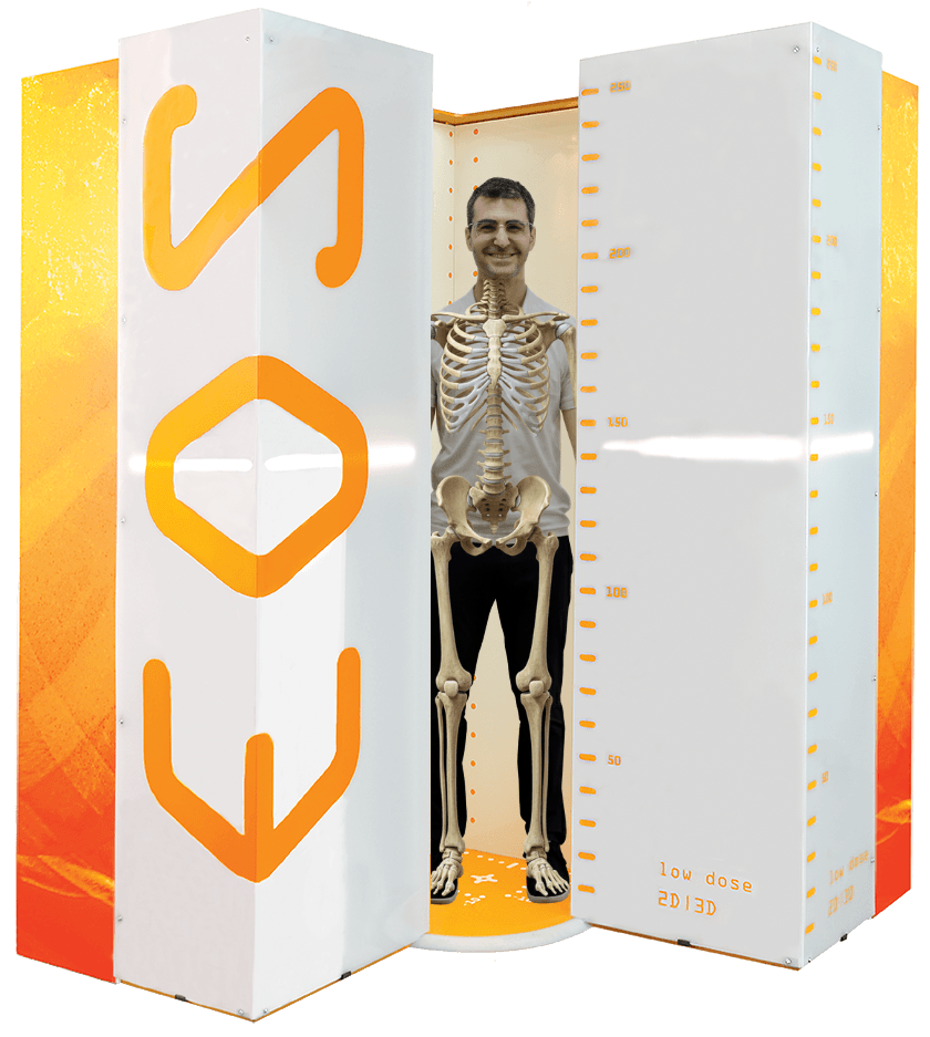 EOS scanner showing full skeletal body scan of standing patient